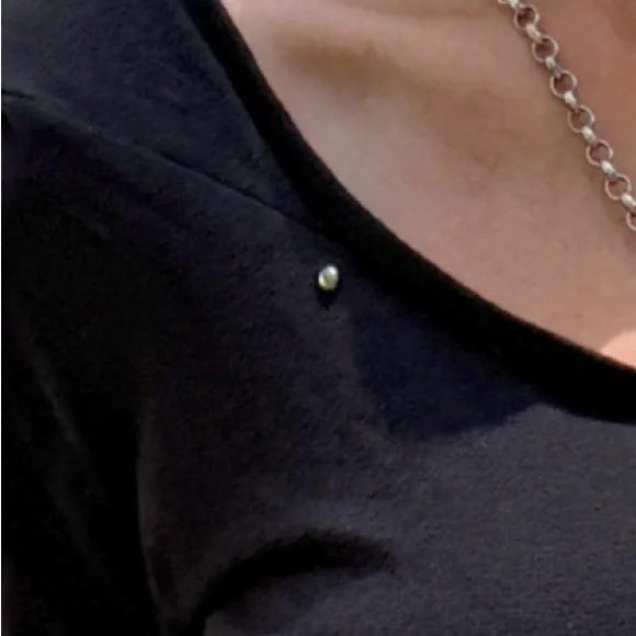 Crossfox Hooded Mini Dress - Picture 5 of 12